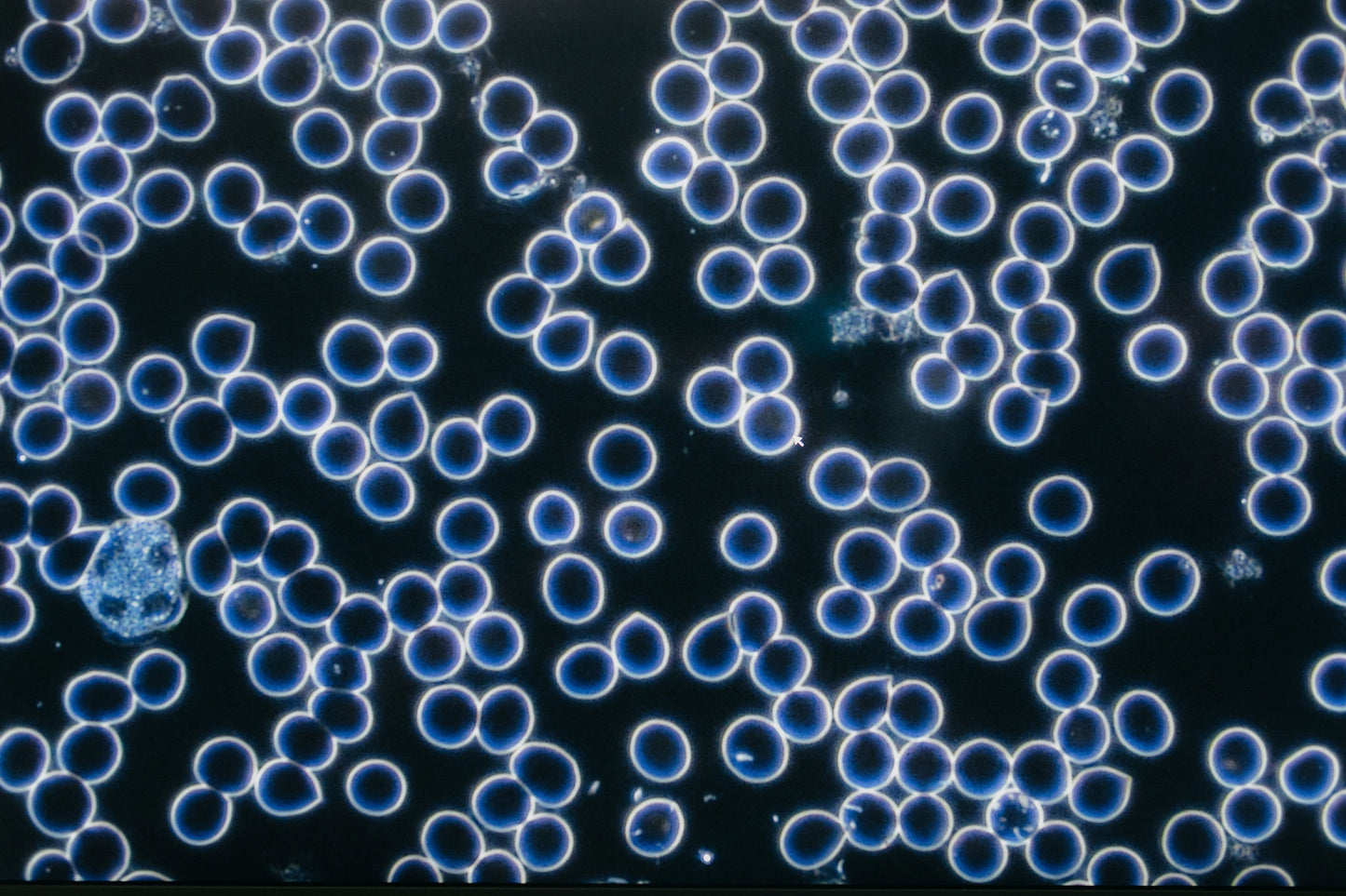 Live Blood & BioEnergetic Testing Follow Up (In-Person)